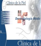 www.clinicadelapiel.com - Atiende casos como acné, vitiligo, psoriasis, botox, restylane, rejuvenecimiento facial sin cirugia y endermología.  contiene presentación, datos g