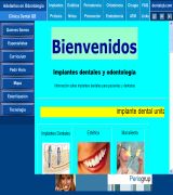 www.dentalqb.com - Implantes dentales y odontología periodoncia en exclusiva enfermedad periodontal mal aliento halitosis encias piorrea clinicas dentales en barcelona 