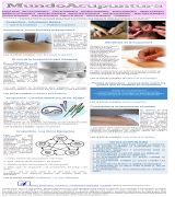 www.mundoacupuntura.com - Beneficios de la acupuntura uso de la acupuntura