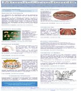 www.mundoortodoncia.com - Todo sobre la ortodoncia tipos de ortodoncia ortodoncia fija y removible