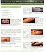 www.todopsoriasis.com - Sitio dedicado exclusivamente a la psoriasis tipos causas que originan la psoriasis diagnóstico y los mejores tratamientos para terminar con la psori